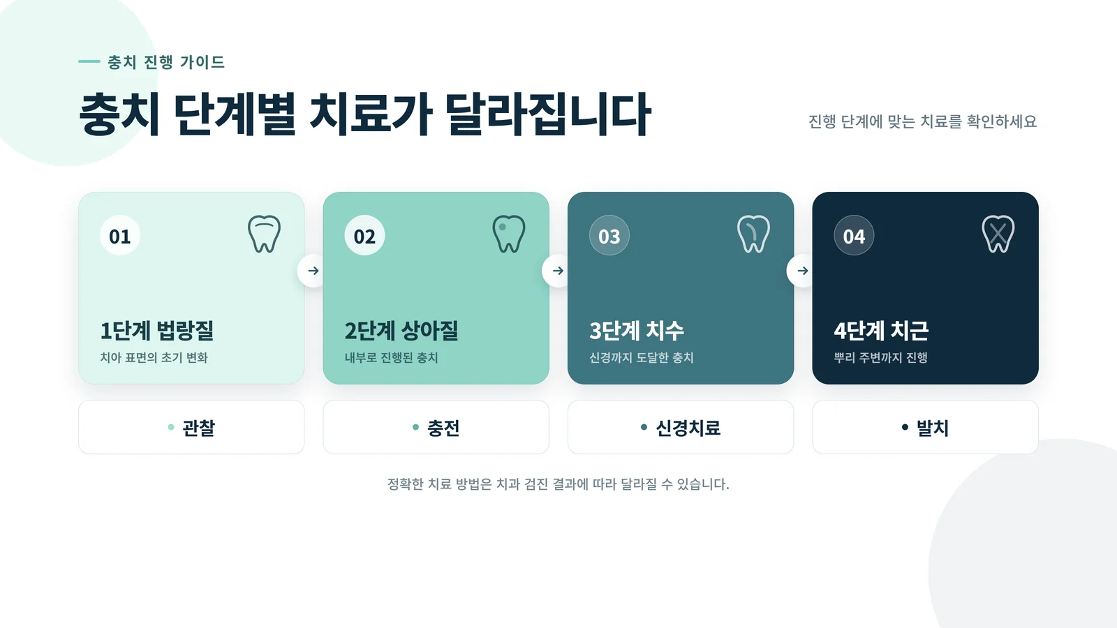 충치 단계별 치료가 달라지는 단계 다이어그램: 1단계 법랑질, 2단계 상아질, 3단계 치수, 4단계 치근