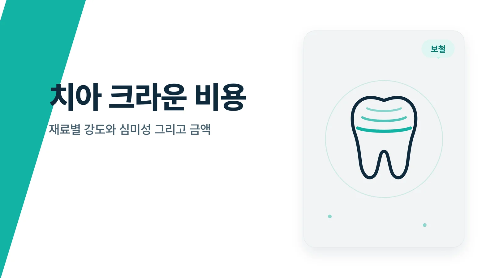 크라운 재료별 강도와 심미성 비교 썸네일
