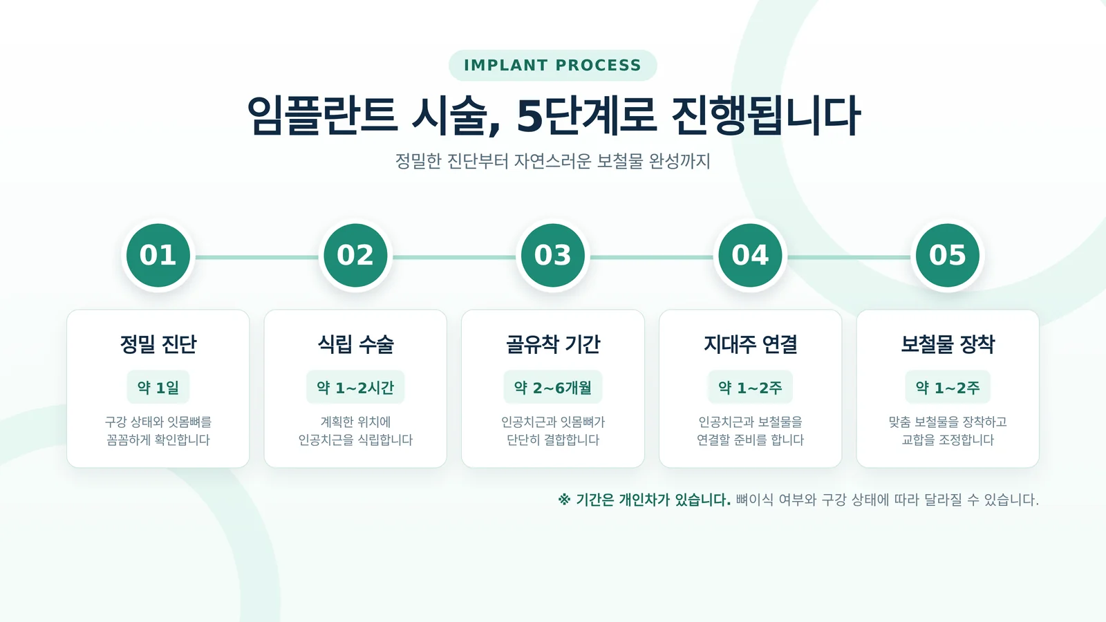 임플란트 시술 과정 단계 안내